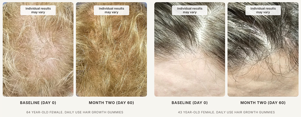 Xtresse Before and After